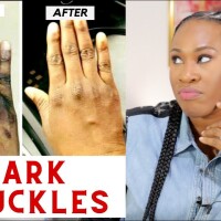 Permanent Skin Bleaching Oil In Vilshult Municipality in Sweden Call ☏ +27710732372